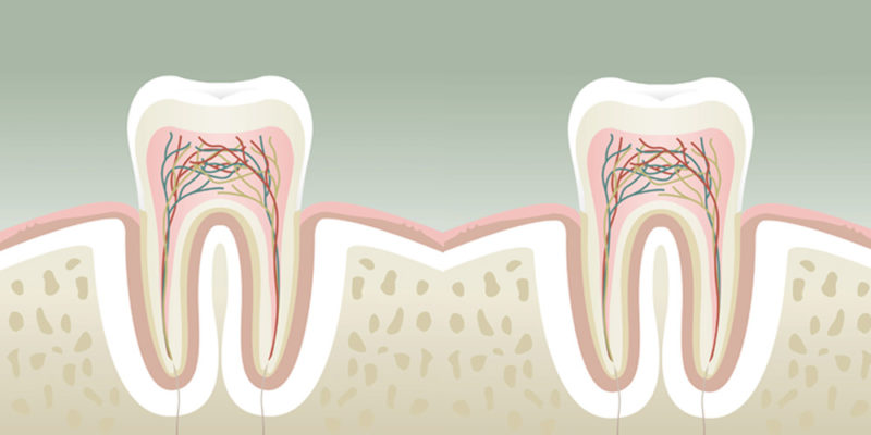 Causes de l’halitose dans la bouche